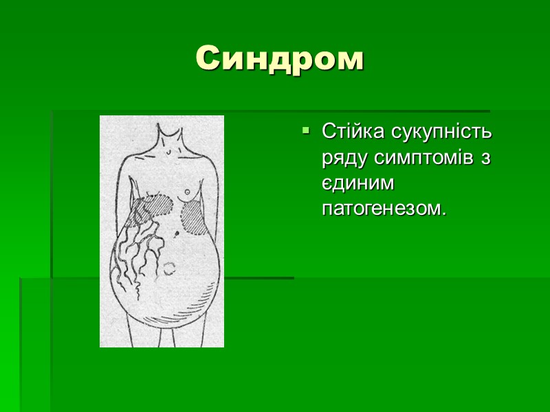 Синдром  Стійка сукупність ряду симптомів з єдиним патогенезом.
